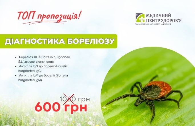 Комплекс «Діагностика бореліозу»