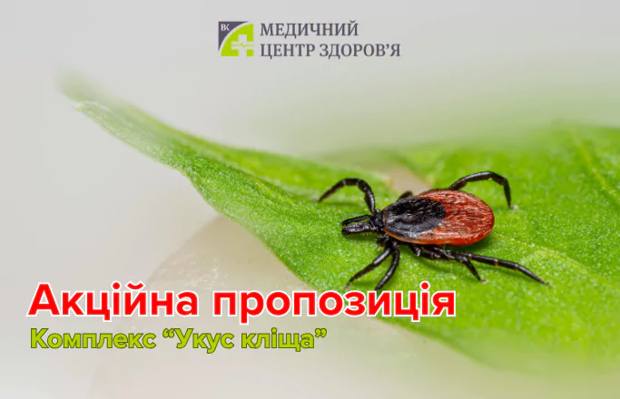 Комплекс “Укус кліща”